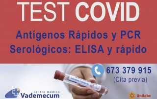 Test rapidos Covid Madrid ciudad universitaria